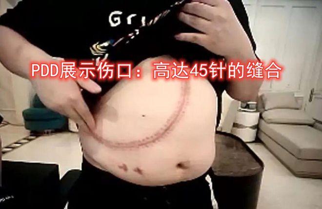 4000名网瘾少年电竞梦碎：你以为躺着赚钱现实比高考还残酷！(图7)